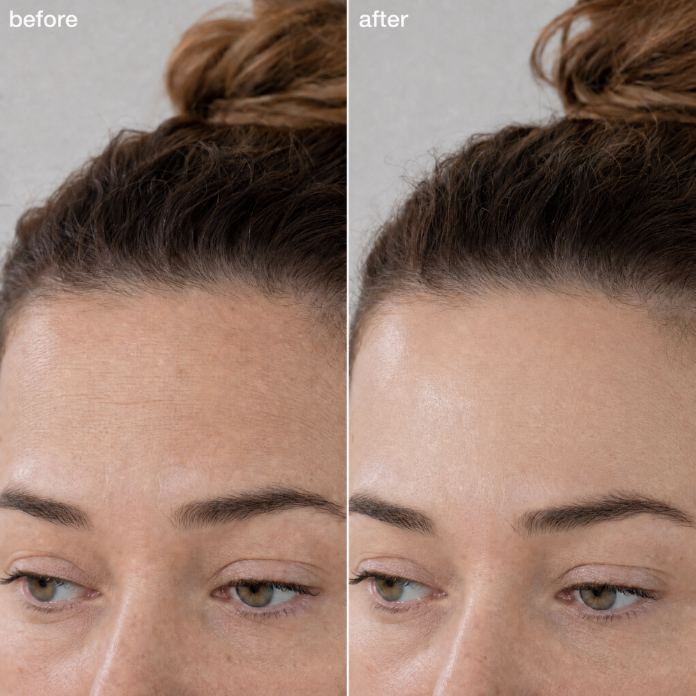Anti Wrinkle & Scar Tape